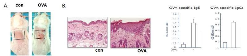 Ovalbumin(OVA) 특이적 아토피 피부염이 유도된 생쥐(A)와 표피조직(B) 및 혈청내OVA 특이적 IgE와 IgG1 농도