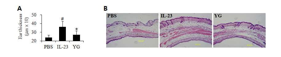 YG 화합물의 IL-23에 의하여 유도된 피부염증 억제 작용