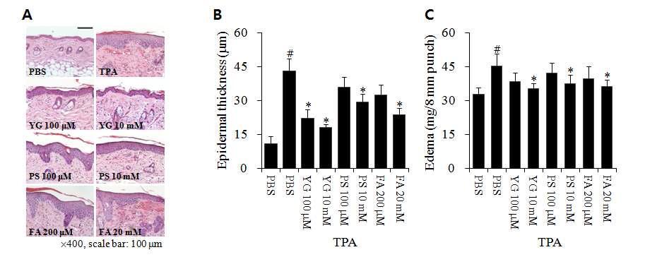 YG 화합물의 TPA 자극에 의하여 유도된 피부염증 억제 작용