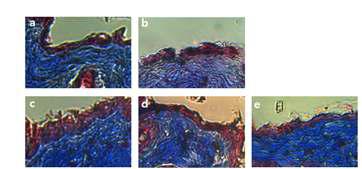 콜라겐 발현 (Masson' s trichrome염색) (a) 정상군 (b) 자연노화군 (c)CW군 (d) PC군 (e) IF군 (이소플라본군)) 및 주름관련 인자