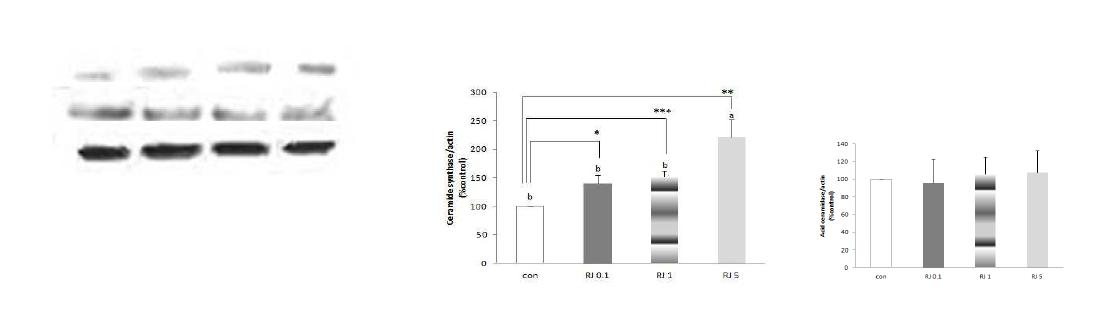 ceramide synthase 및 Acid ceramidase 단백질 발현 변화