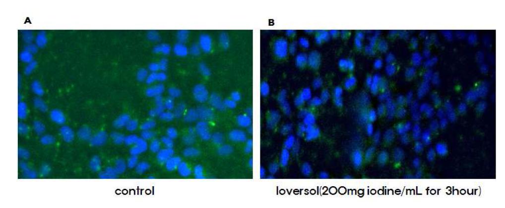 Ioversol (200mg/mL, 3시간)에 의한 Caspase-3 활성화 조사