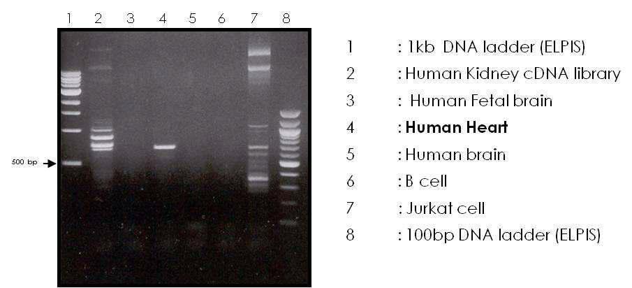 사람유래 각 조직의 total RNA에서의 EC-SOD RT-PCR 결과