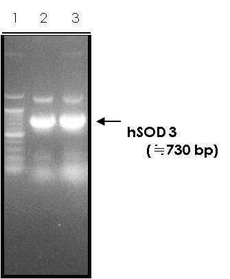 확보된 사람 SOD3 유전자 단편에서 2차 중합효소연쇄반응법 증폭 결과