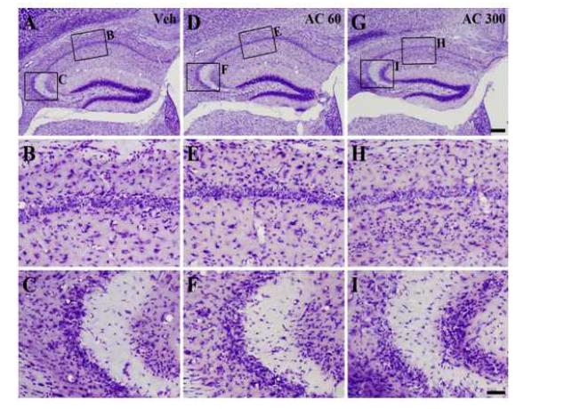 Evaluation of acorn extract on hippocampal cell in epileptic condition. Cresyl violet stain