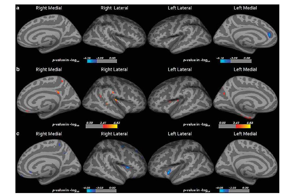 Statistical maps showing the regions of cortical thickness correlated with HAM-D17 totalscore (a), CERAD-K word list recall score (b), and Stroop Word-Color Interference testscore (c) in the LOD group (po0.05 FDR corrected). Maps are shown for right and lefthemispheres in lateral and medial views respectively, and significant regions are shown inblue (negative correlation) and red (positive correlation). LOD, late-onset depression;CERAD-K, Korean version of Consortium to Establish a Registry for Alzheimer’