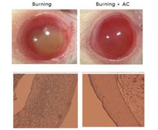 Findings from cornea alkali burn model after the topical eye drop administration