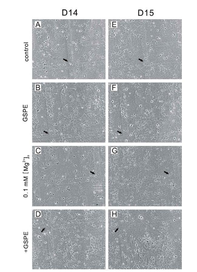 GSPE protects cells against 0.1 mM [Mg2+]o?induced neurotoxicity