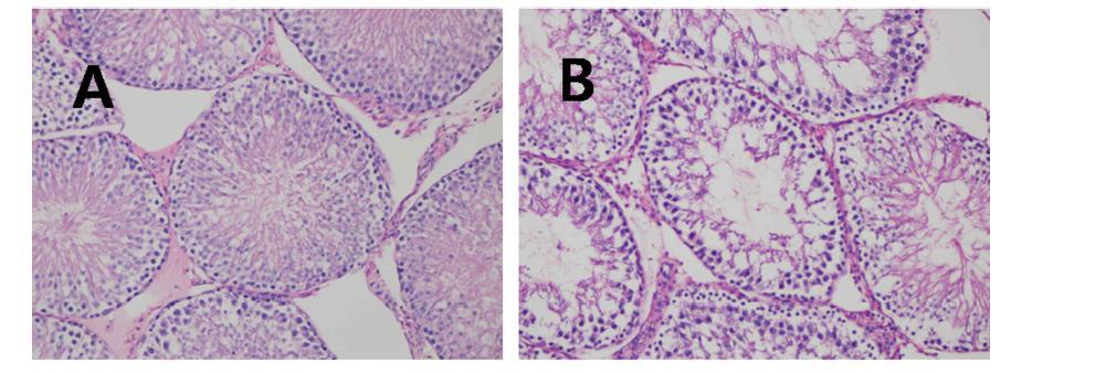 Histopathologic findings in control (A) and varicocele mouse (B)