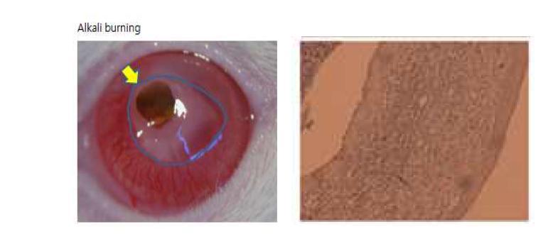 cornea neovascularization model