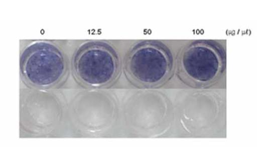 (Right) Effect of Anthocyanin on MC3T3-E1 differentiation and mineralization. ALPwas visualized by ALP staining at differentiation day 5.