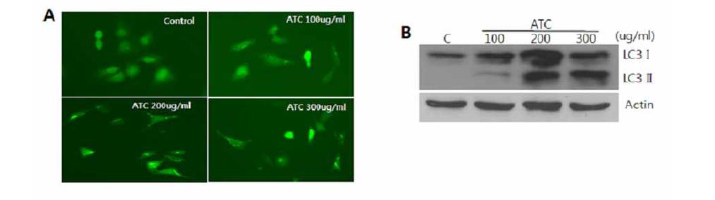 Induction of autophagy by anthocyanin. LC3 formation after anthocyanin treatment onU2OS cell (A). Conversion of LC3 I to LC3 II in the same condition as (A) (B)