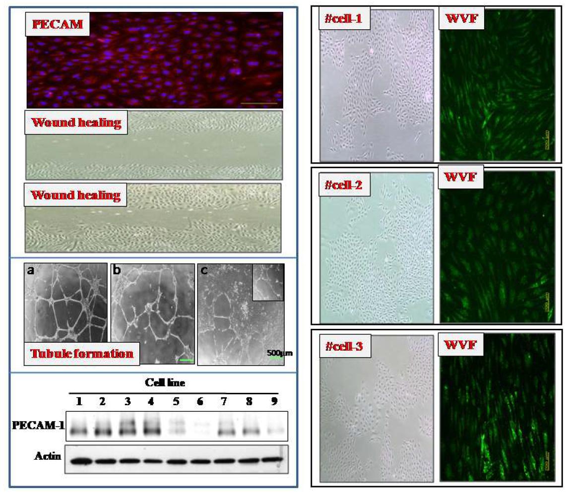 탯줄유래 endothelial cell lines