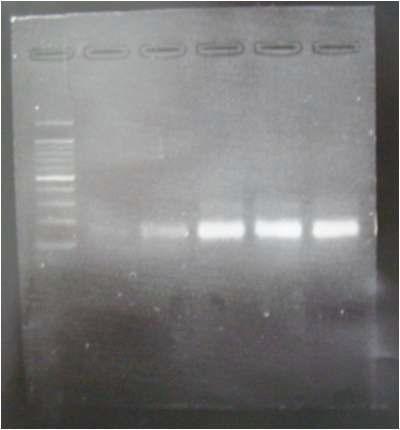 DNA template의 PCR 결과