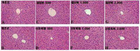 칠보벼(상) 또는 신토흑미(하)의 용량별 투여 14일 경과 후에 따른 간의 미세현미경적 소견