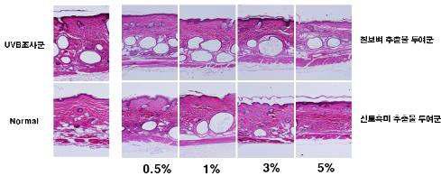 UVB 조사 및 시험물질 도포에 따른 20주 후 피부미세구조변화