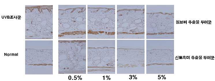 UVB 조사 및 시험물질 도포에 따른 20주 후 피부두께 억제 효과