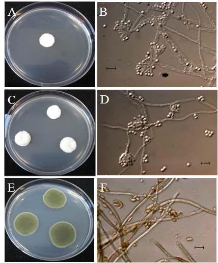 Observation of Aspergillus and Cladosporium colonies and microscopic morphologies.