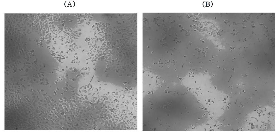 Anticancer effect of extract of RSP in the viability of A-549(lung cancer).