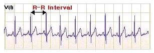 ECG RR-Interval