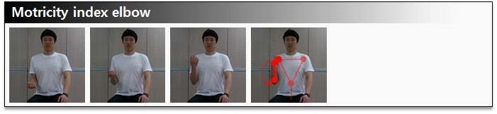 그림 54. Motricity index elbow