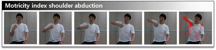 그림 55. Motricity index shoulder abduction