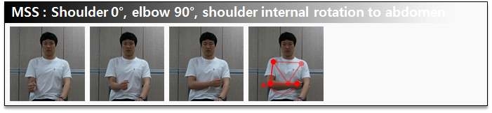 그림 59. MSS: A. Shoulder 0°, elbow 90°, shoulder internal rotation to abdomen