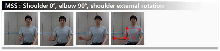 그림 60. MSS: Shoulder 0°, elbow 90°, shoulder external rotation