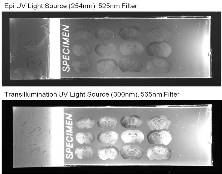 Fluorescence images from small mice brain slices.