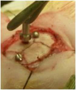 A rat under a surgical procedure with an optical fiber probing unit.