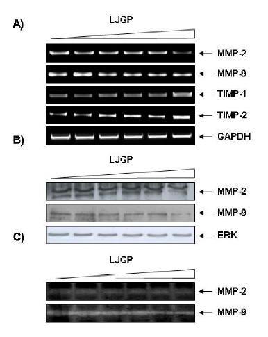 Effects of LJGP on the expression of TIMPs and MMP mRNA (A) andproteins (B), and activity of MMPs (C) in AGS human gastric cancer cells