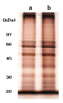 Extracted protein profiles of lysis solutions A and B Lane (a), lysis solution A; (b), lysis solution B In total, 5 g of extracted μ proteins was loaded