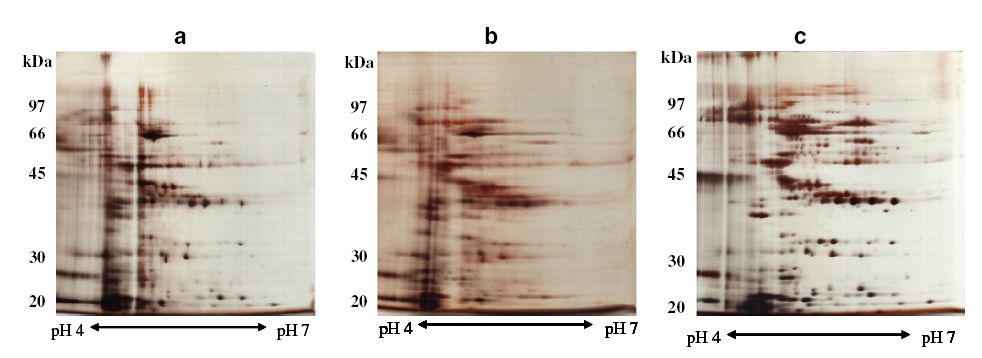 Comparison of 2-DE patterns of S. japonica proteins extracted usingdifferent detergents.