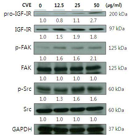 Effects of CVE treatment on IGF-IR, FAK and Src expression inIEC-6 cells