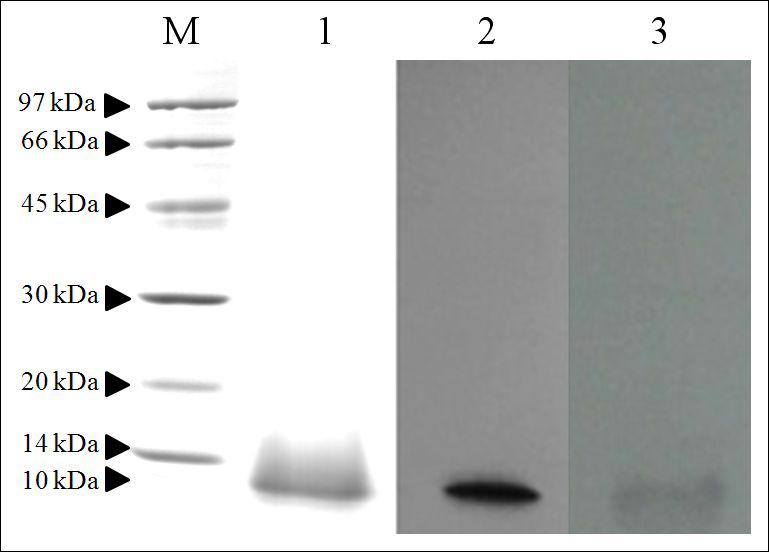 The electrophoresis profiles of glycoprotein from S. japonica.