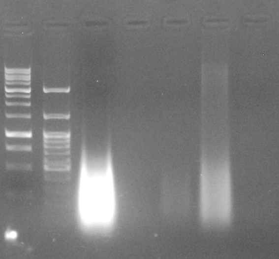 그림 Ⅱ-1-2-2. 5종 연산호 DNA의 전기영동 확인