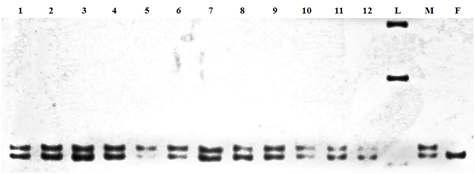 Detection of the allelic variation for amelogenin locus in PCR products. Electrophoresis in 6% polyacrylamide gel and visualized by silver-staining. Lanes are as follows: 1-12, male samples; L, 1Kb+ DNA size ladder; M, male control sample; F, female control sample.