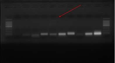 Taenia에 대한 공주 고분 샘플의 PCR. Lane 1; size marker, Lane 2-4: Taenia solium primer, Lane 5-7; Taenia saginata primer, Lane 8-10: Taenia asiatica primer, Lane 11: negative control. Taenia saginata에 대해 희미하게 양성 반응을 보이고 있다 (화살표).