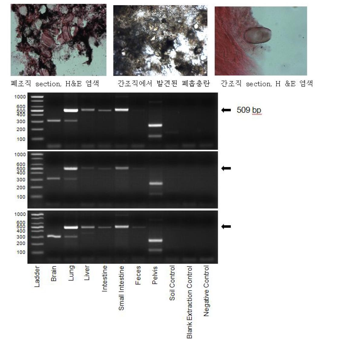 하동 미라의 간과 폐에서 폐흡충란이 관찰되는 모습(위). 하동 미라의 폐흡충에 대한 각 장기 별 PCR 결과.