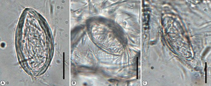 미라에서 발견된 요충란의 모습. Bar = 20 ㎛.