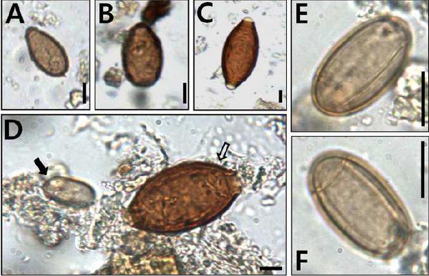 충남 당진의 미라에서 발견된 기생충란들.