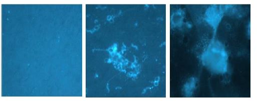 그림 30. (좌)사육 초기의 사육수. DAPI 형광염색 현미경 사진(×1,000); (중앙) Biofloc 발달 중인 사육수; (우) Biofloc이 잘 발달된 사육수. 세균이 유기물과 결합하여 biofloc을 형성한다.