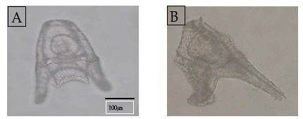 그림 2-2. 둥근성게(Strongylocentrotus nudus)의 정상(A) 플루 테우스 유생과 비정상(B) 플루테우스 유생의 형태.