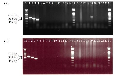 그림 4. VH-4F, VH-7R, PD-1F, PD-1R, VI-F3와 VI-R1 프라이머를 이용한 multiplex-PCR후 1.5% agarose gel 전기영동 분석