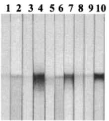 간흡충 항원들의 간흡충증 환자 혈청 (10 건)과의 면역블롯 (immunoblot) 결과