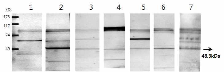 정제된 간흡충 재조합 단백질(pGST4T-1-CsTP22.3)를 100ug을 SDS-PAGE를 수행한 다음 니트로셀룰로오스 막(nitrocellulose membrane)으로 옮긴 후 간흡충증 환자들의 혈액과 실온에서 1시간 반응시켰다. 이것을 0.1% Tween20 이 포함된 PBS로 씻은 후 항 인간면역글로블린-HRP 축합체 (anti-human IgG-HRP conjugate)와 반응시켰다. lane 1: normal serum; lane 2~7: clonorchiasis patient sera