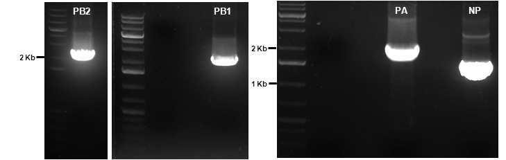 PCR 결과