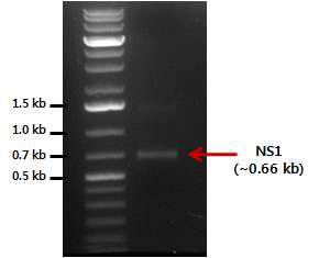 PCR 결과