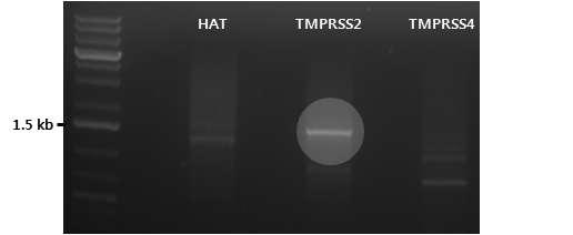 막횡단단백효소(TMPRSS2)의 PCR 결과