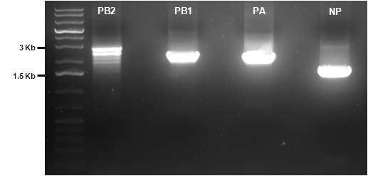 PCR 결과